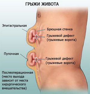 Мануальная терапия